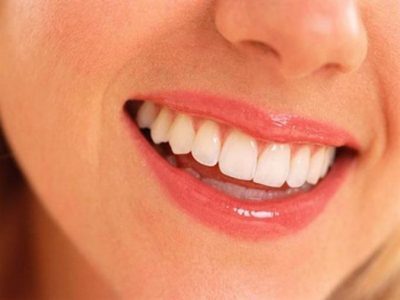 5 طرق للتخلص من اصفرار الأسنان